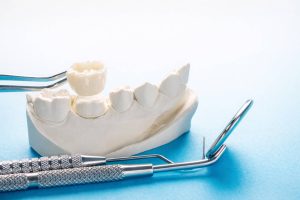 An image of a dental crown with tools in the background