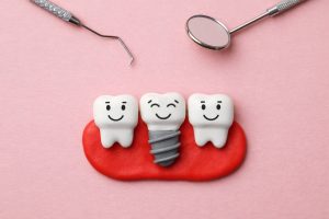An image of a dental implant between 2 teeth, for the blog entitled, "Types of Dental Implants"