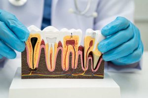 an image in connection about the topic, "what is endodontics?"